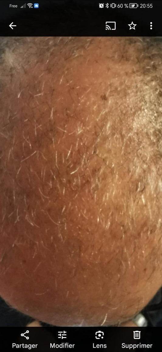 On voit mon crâne à travers mes cheveux: solutions! - FKsecret