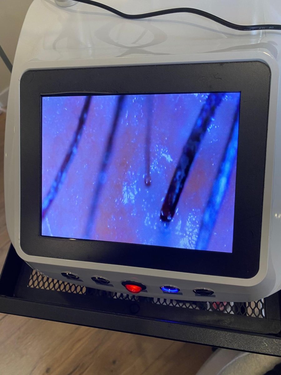Diagnostic Capillaire - Technicienne en Trichologie - FKsecret
