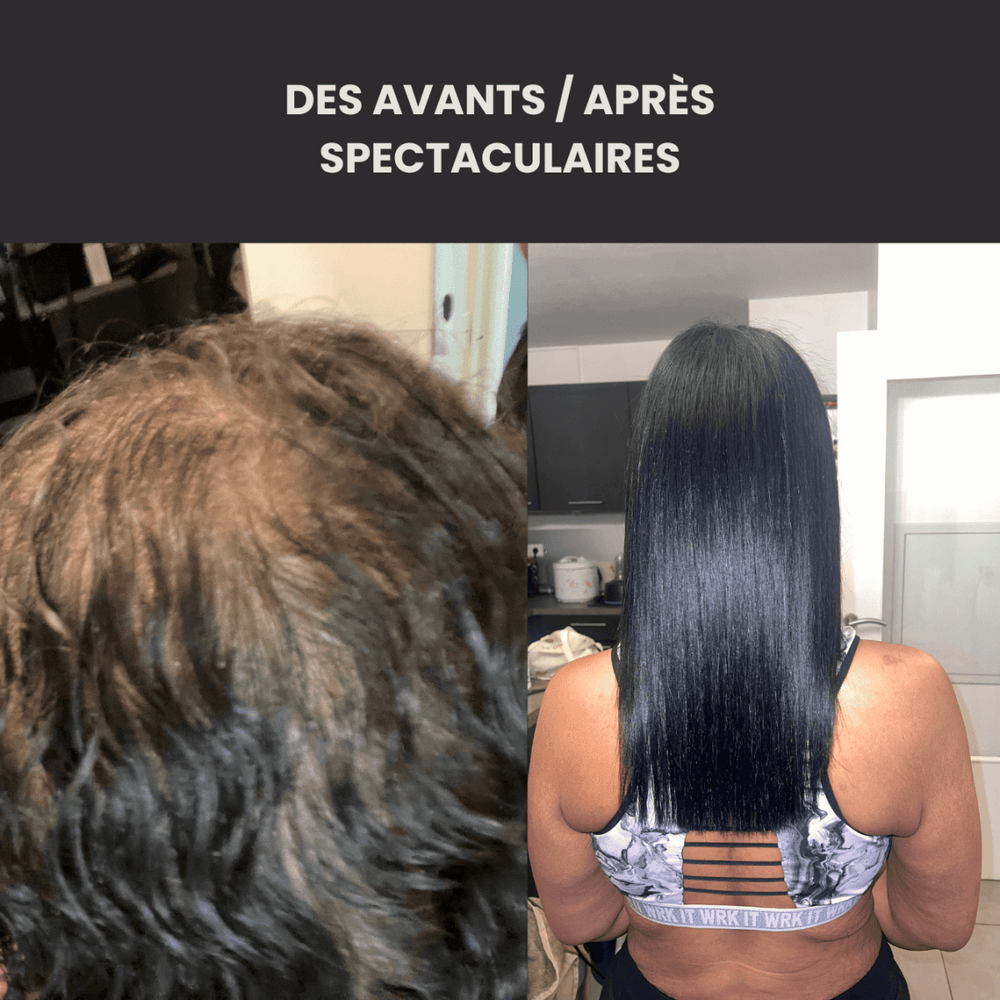 Coffret - Rituel de pousse - FKsecret