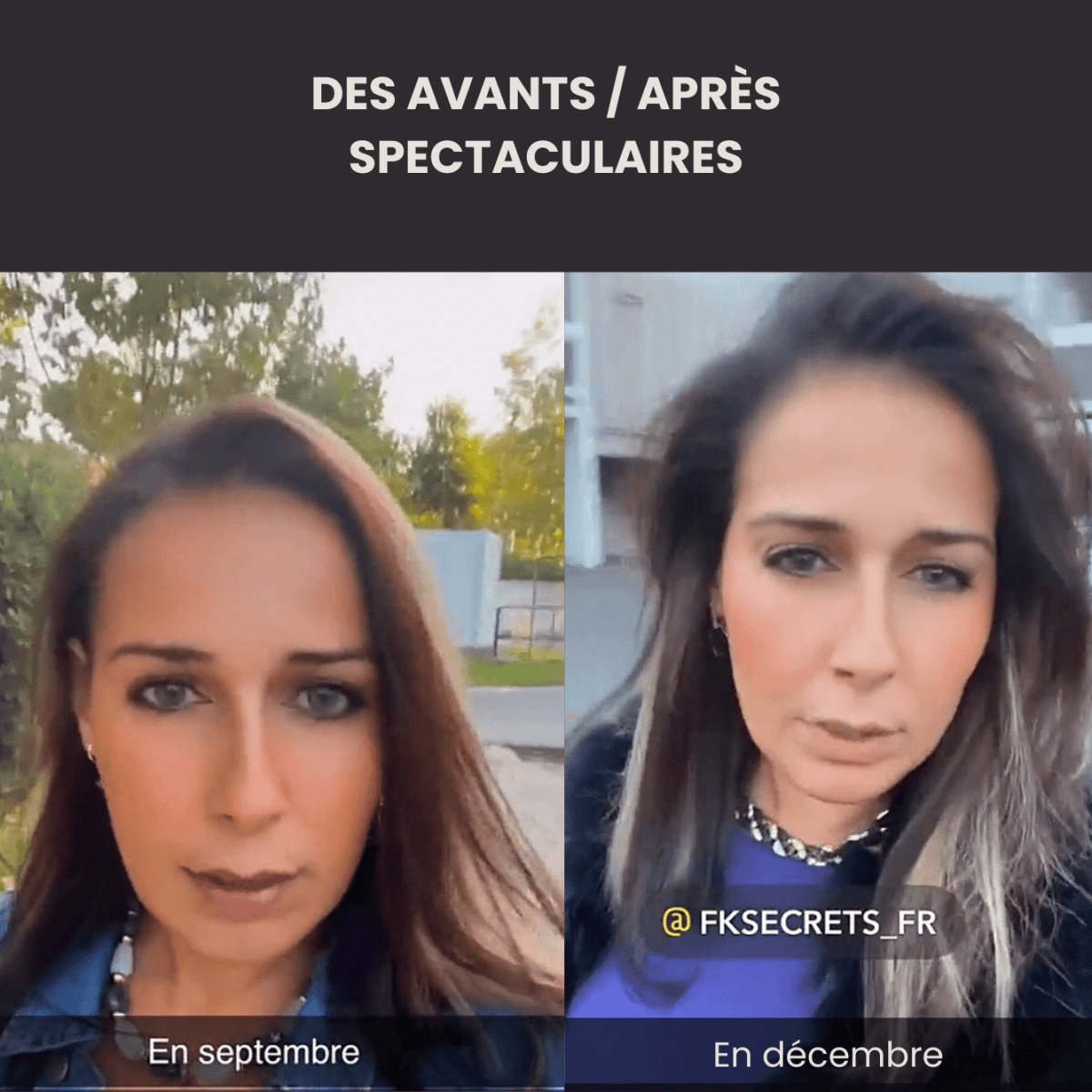 Coffret - Rituel de pousse - FKsecret