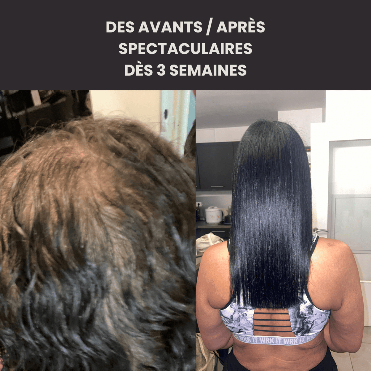 Huile Précieuse de Pousse : anti zones dégarnies, pelade et perte de volume - FKsecret