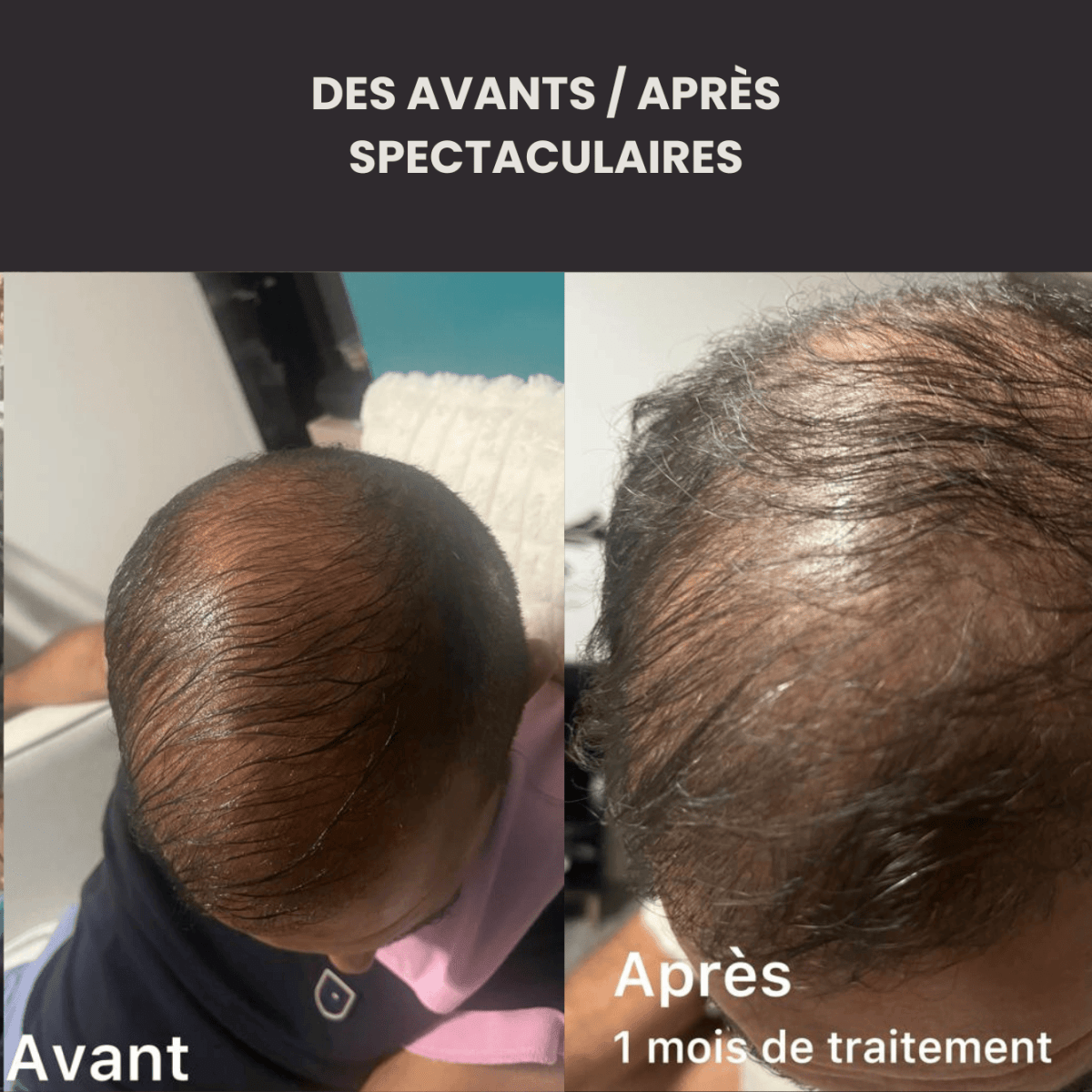 Le Coffret Rituel Pousse Homme (cheveu et barbe) - FKsecret