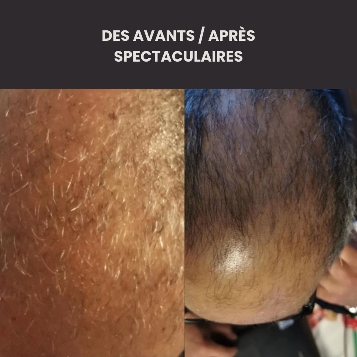 Le Coffret Rituel Pousse Homme (cheveu et barbe) - FKsecret